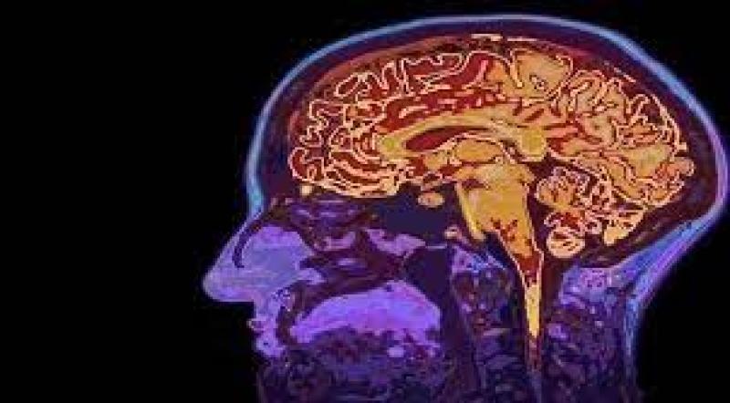 وسيلة جديدة لقراءة الأفكار دون الحاجة للتدخل جراحيا في المخ