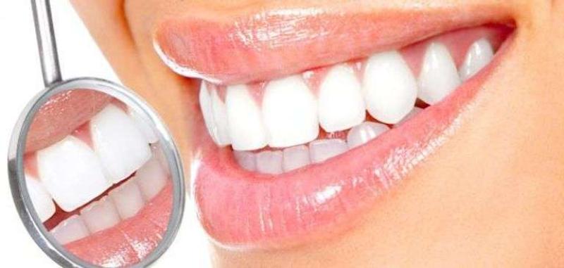 تجميل الأسنان الأمامية بدون تقويم